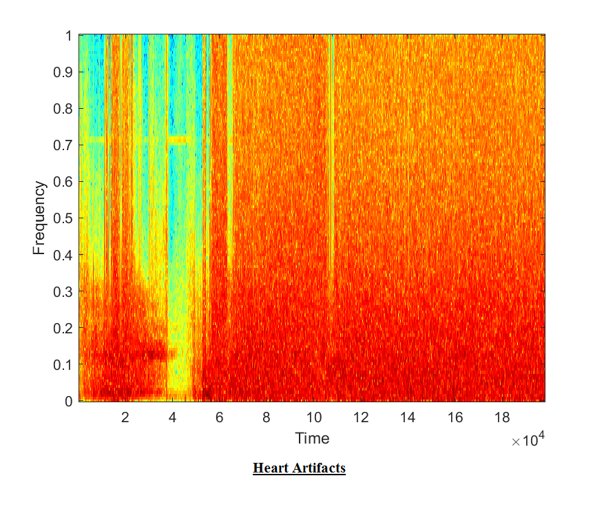 Heart Sound detection